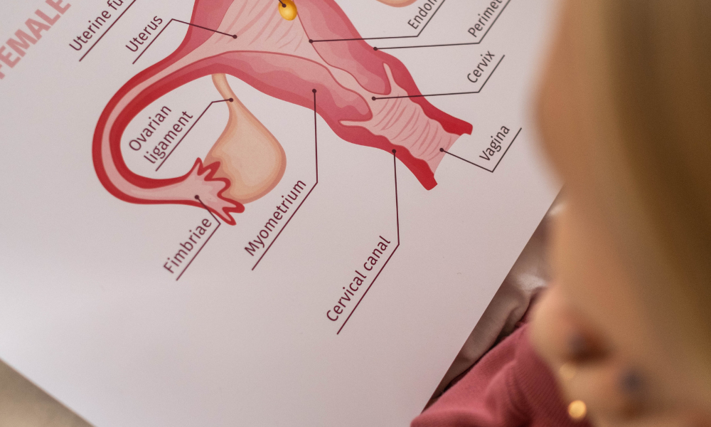 Endometriosis in Malta